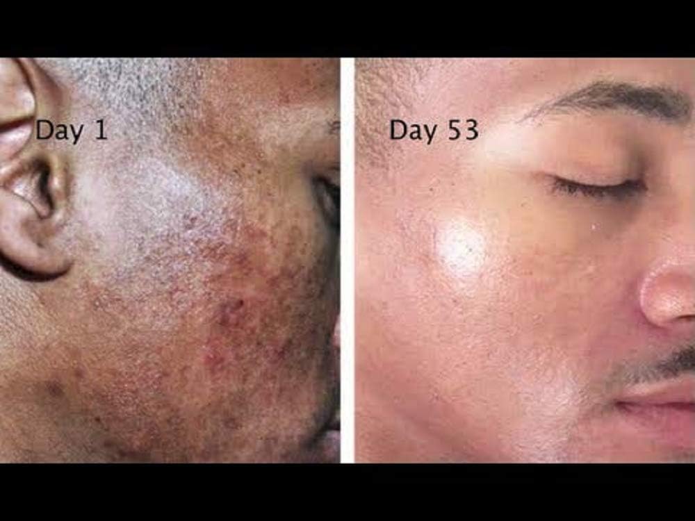 Perfect skin body whitening milk